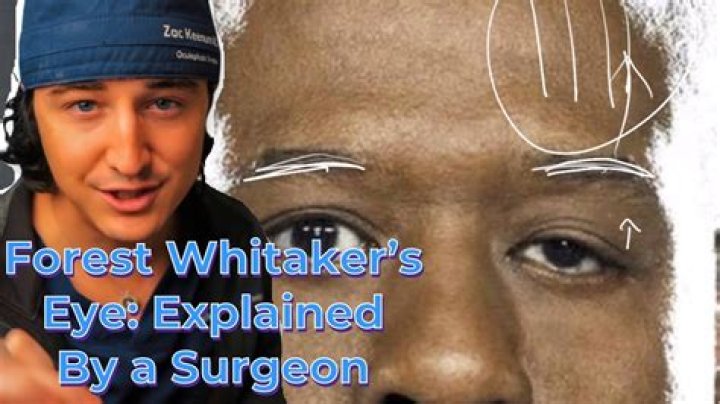 Forest Whitaker's Eye Condition Unveiled